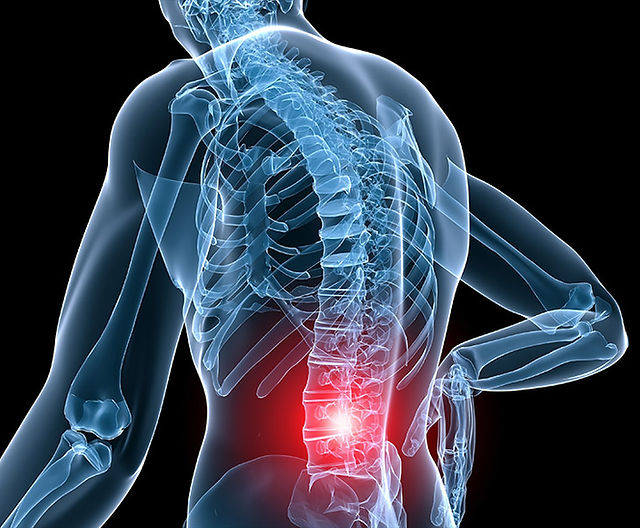 Produse de atenuare a disconfortului articular și muscular: tratamente bazate pe dovezi care funcționează